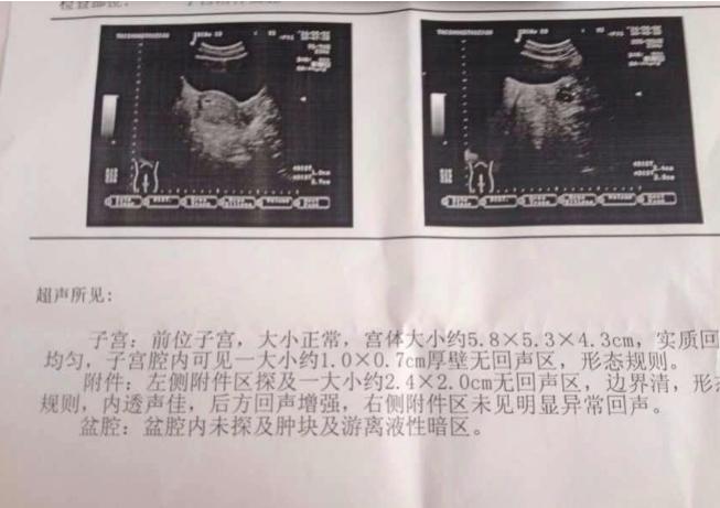 早孕检查第几周去,早孕六周检查还是8周检查