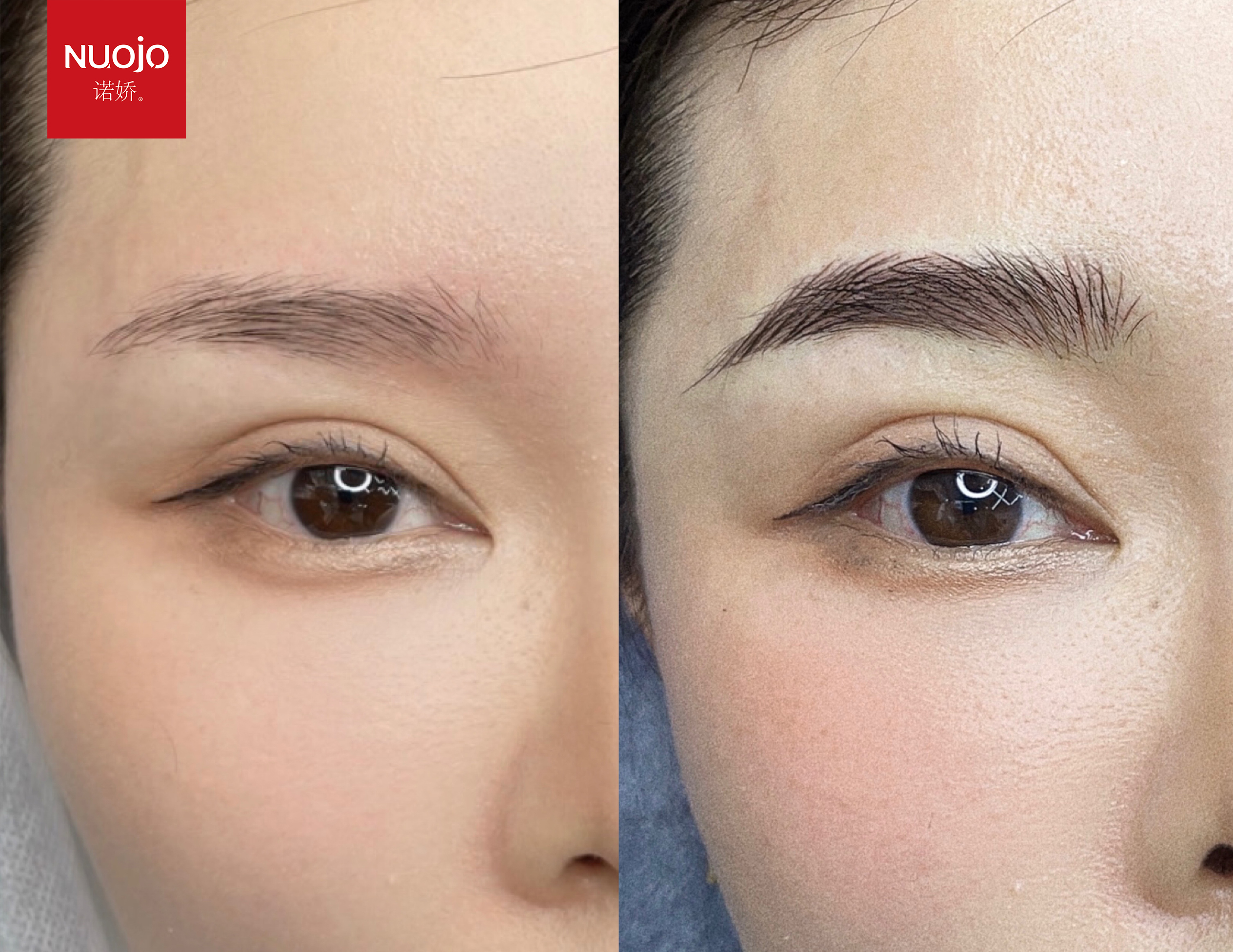 纹眉后一般出现不舒服在什么时候,纹眉补色后出组织液还头晕