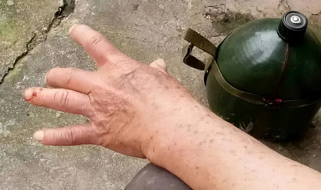 55岁大叔非要表演口吞毒蛇，被蛇咬舌身亡，草原蝰毒性有多大？