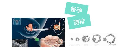 备孕指标详细对照表,备孕注意事项请收下这份清单