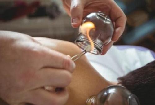 拔罐的黑印真的是体内毒素吗？拔罐师傅给出解释，看完长见识了！