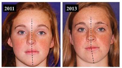 为什么脸会一边大点一边小点,为什么脸会一边大一点