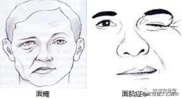 千年绝技完整版视频,千年国医之针灸奥秘