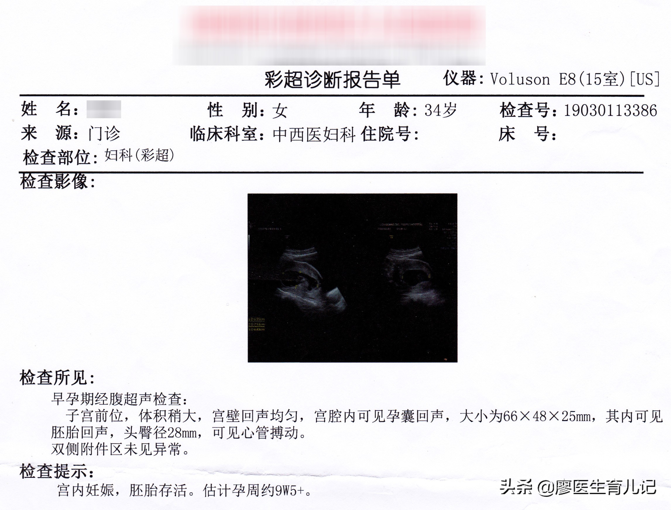 度过孕期危险期,度过孕早期的焦虑