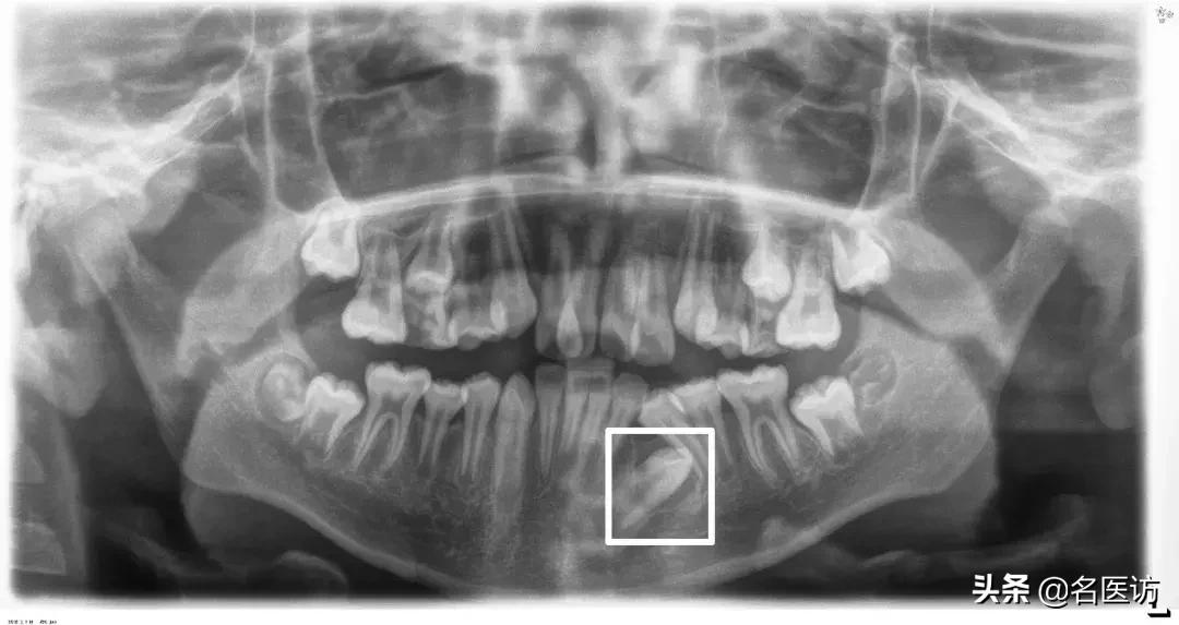 矫正牙科普馆,矫正牙齿科普知识