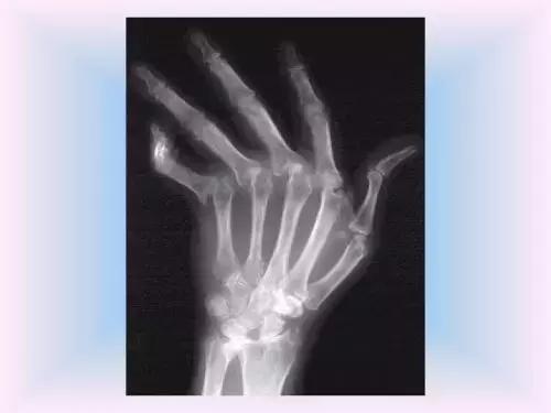 卵巢早衰，人易老！这5种表现都在告诉你：不保护就老了