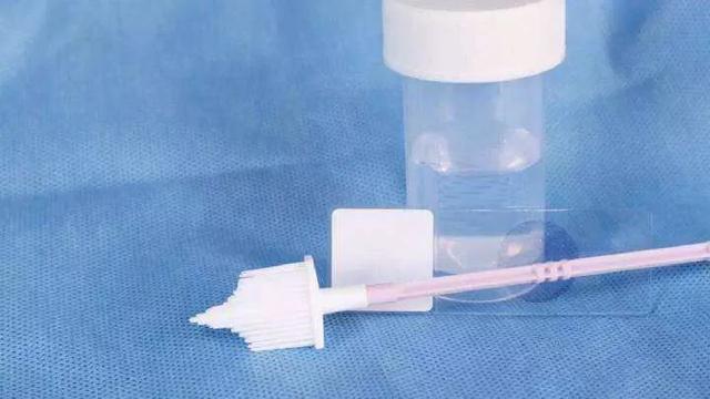 一招预防宫颈癌，TCT了解一下