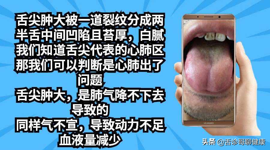 抖音舌诊和微信舌诊,抖音舌诊