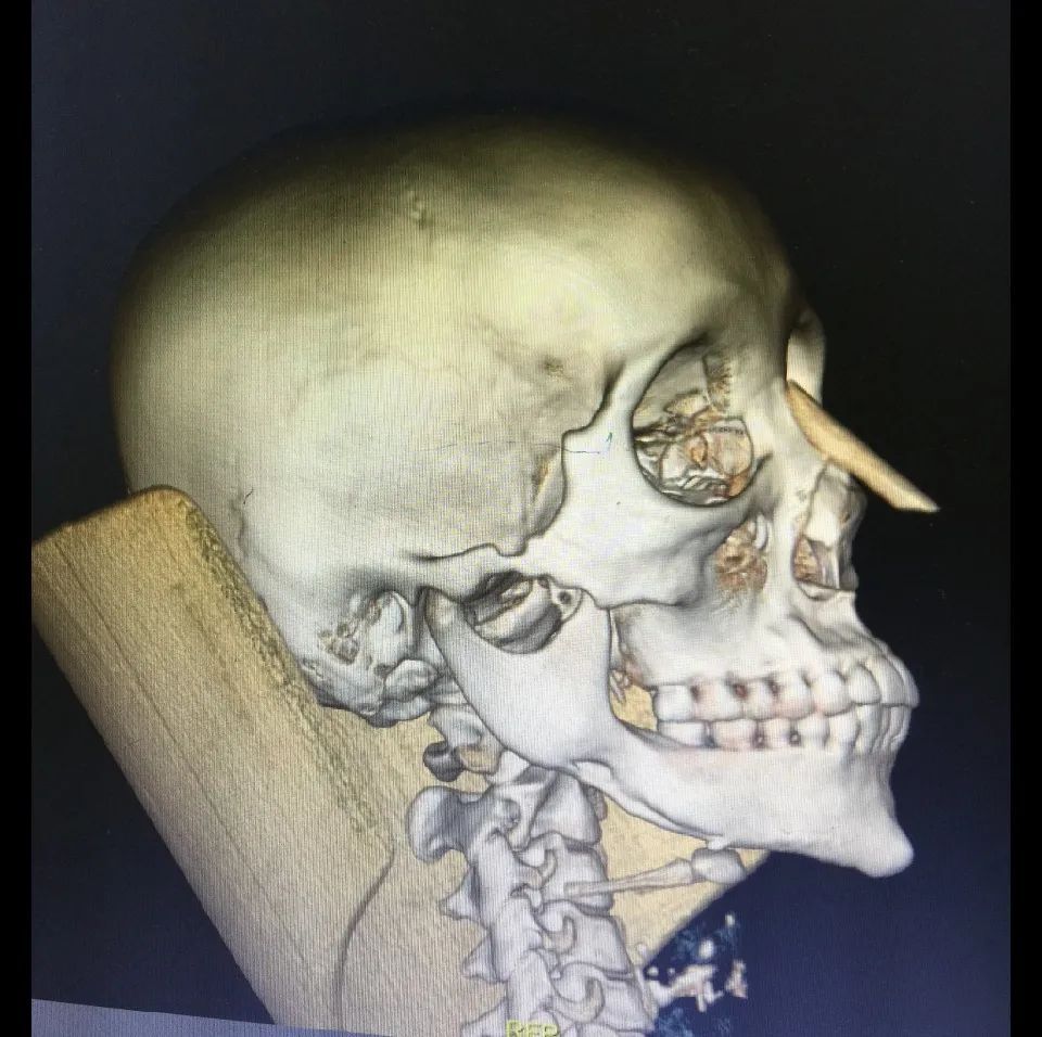 哪些情况下不适合整形,什么整形手术最容易失败