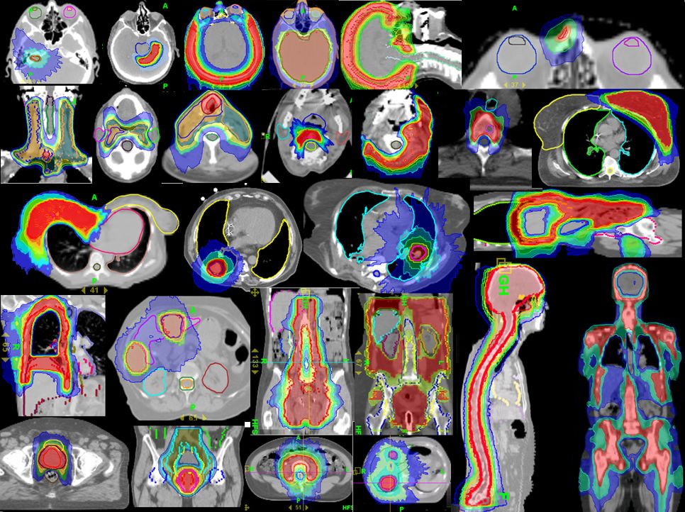 治癌症的最新突破,癌症最新技术突破是什么
