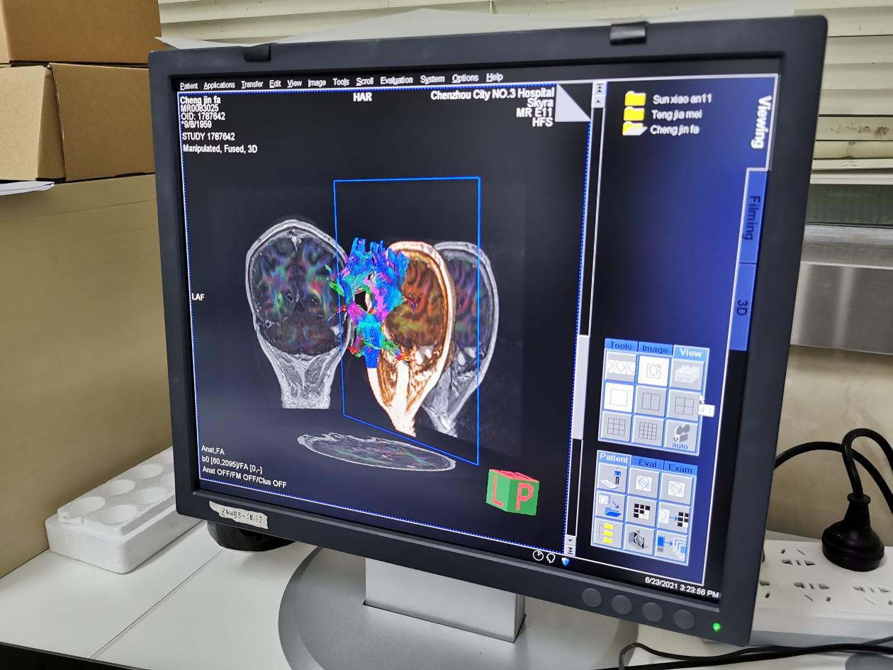 又添高精尖大型设备！德国西门子磁共振亮相郴州市第三人民医院