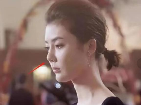 盘点一些有问题的鼻子,明星都没整好的鼻子