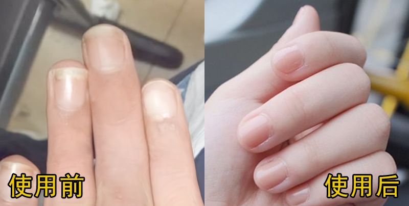 德国造指甲刀,德国制造的工具果然名不虚传