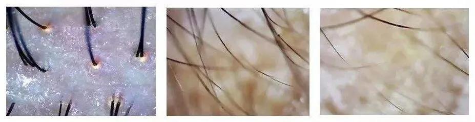 明星亲测|康王创始人83岁再出山，挑战5天内不洗头