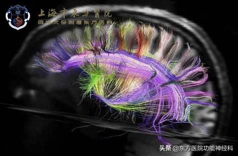 终生服用抗精神病药对身体的危害,正常人长期吃抗精神病药会怎样