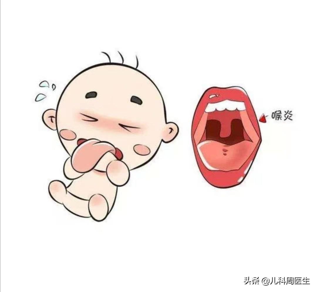 犬吠样咳嗽伴有呼噜声怎么缓解,哪些病会引起犬吠样咳嗽