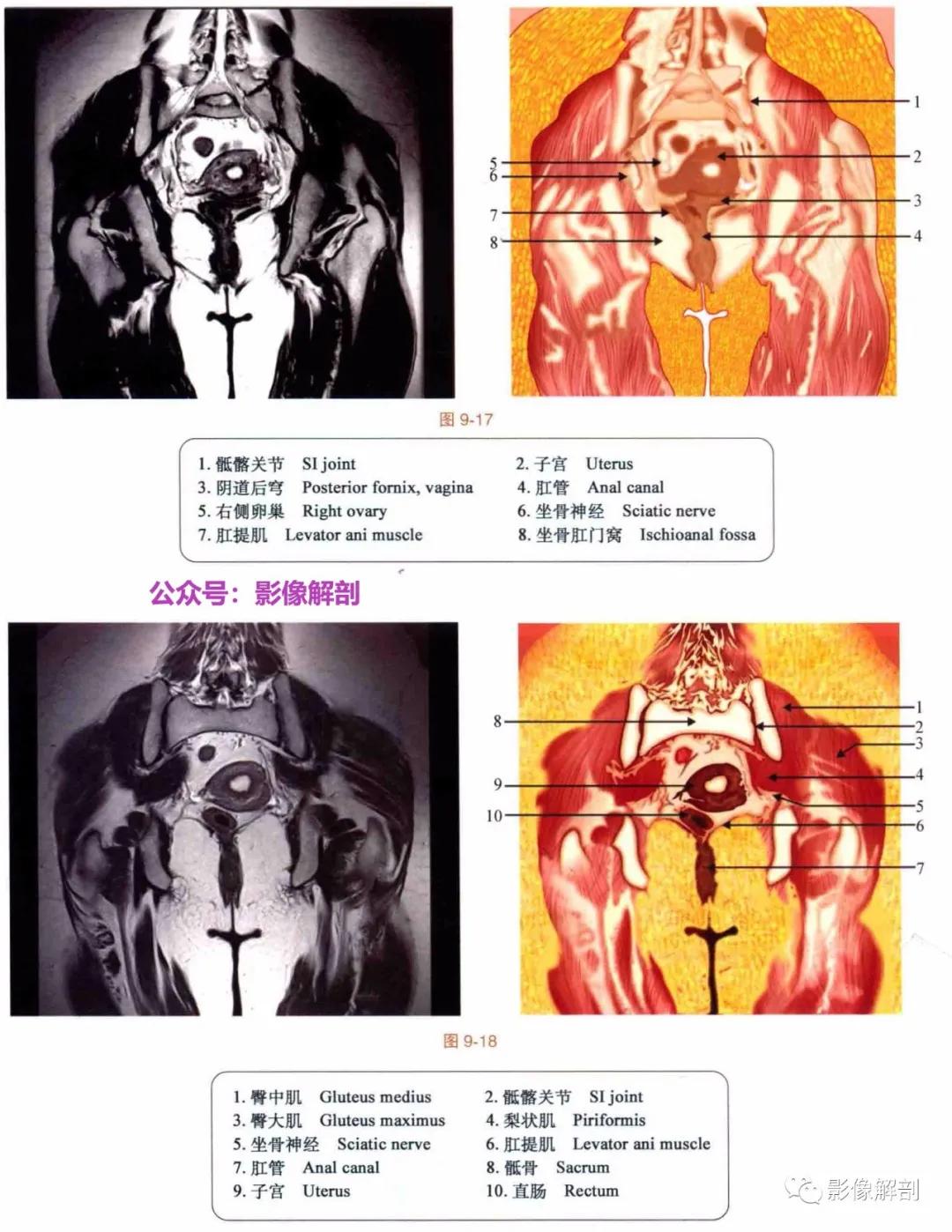 女性盆腔矢状位断层解剖,男性盆腔磁共振断层图谱