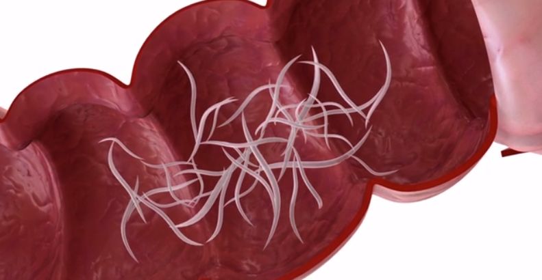 孩子打虫的季节,小孩子打虫的季节