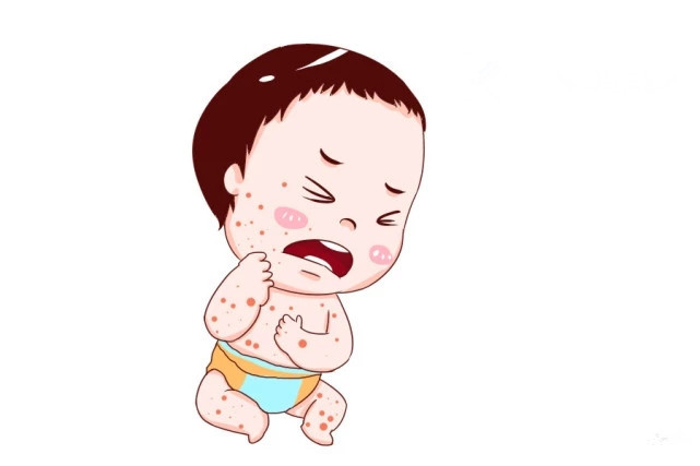 医院新生儿皮肤护理,新生儿皮肤破损怎么护理