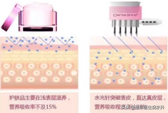 一次水光等于1000张面膜是真的吗,打水光针有副作用吗有依赖性吗