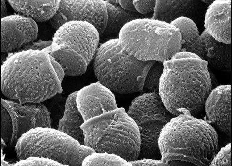 梦禾科普｜如何对付烦人的头皮屑