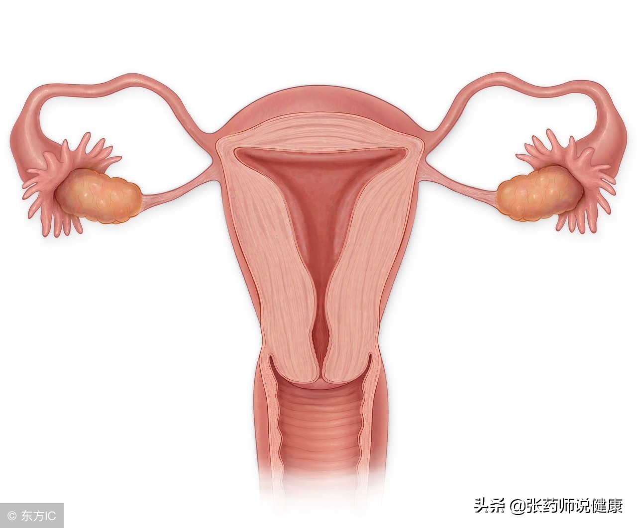 妇科肿瘤的信号别忽视,警惕妇科肿瘤年轻化