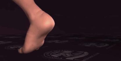 跟腱断裂康复的几个阶段,跟腱断裂手术三周跟腱恢复情况