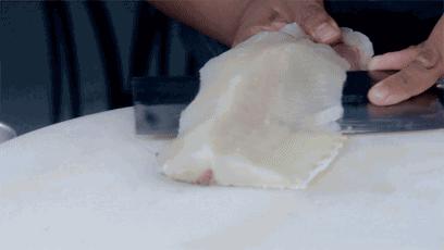 一名女子体内取出3000多颗胆结石,胆结石取出活虫