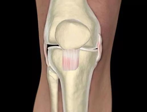 科普:膝关节不小心拉伤?疼痛事小,侧副韧带损伤才是大问题