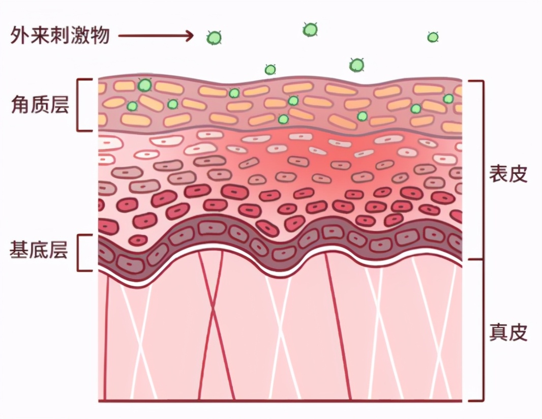 贴面膜有点小刺痛是缺水吗,脸部缺水贴面膜会刺痛是怎么回事