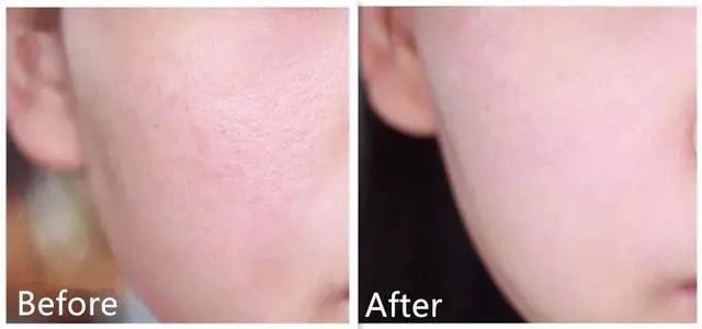 适合熬夜皮肤暗沉的护肤品国货,国货拯救黄黑皮