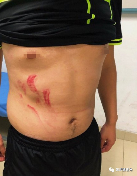 业余联赛裁判遭飞踹,业余联赛惊现球员飞踹裁判场景