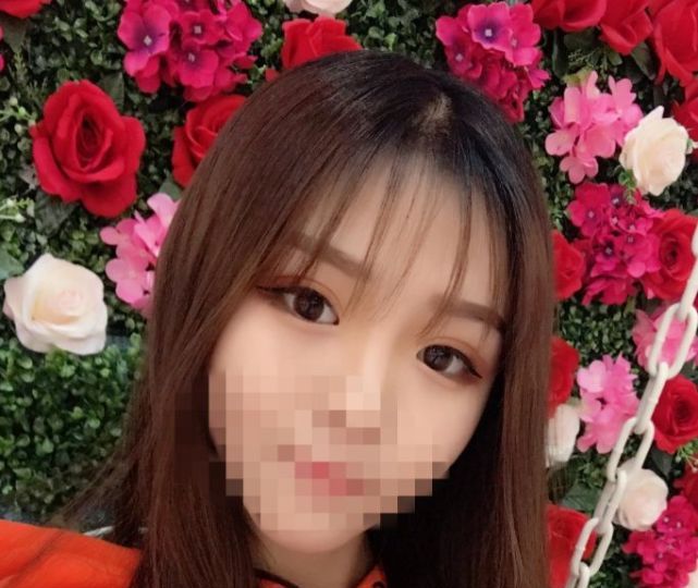 医生说我不适合做线雕,医生说我不适合做飞秒手术