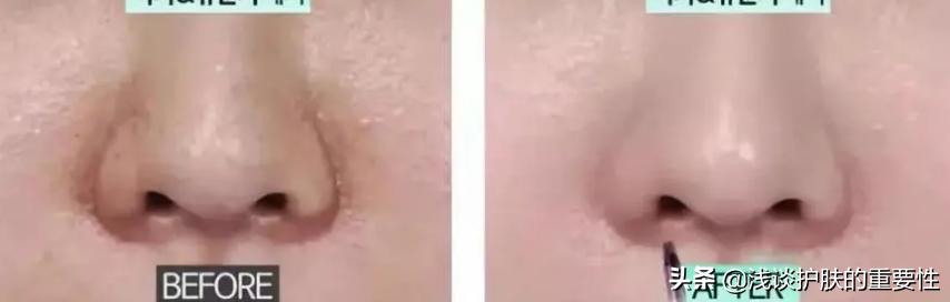 皮肤光滑细腻去角质,去角质可以让脸变白吗