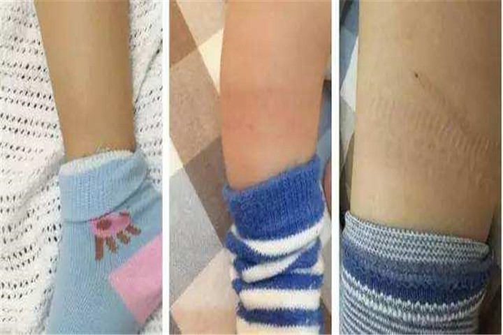 孩子为什么会脚热不爱穿袜子,孩子光脚不穿袜子好吗