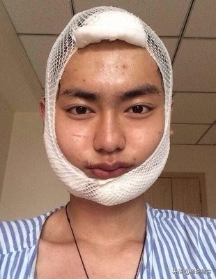 为什么会下颌突出,为什么下颌角突出