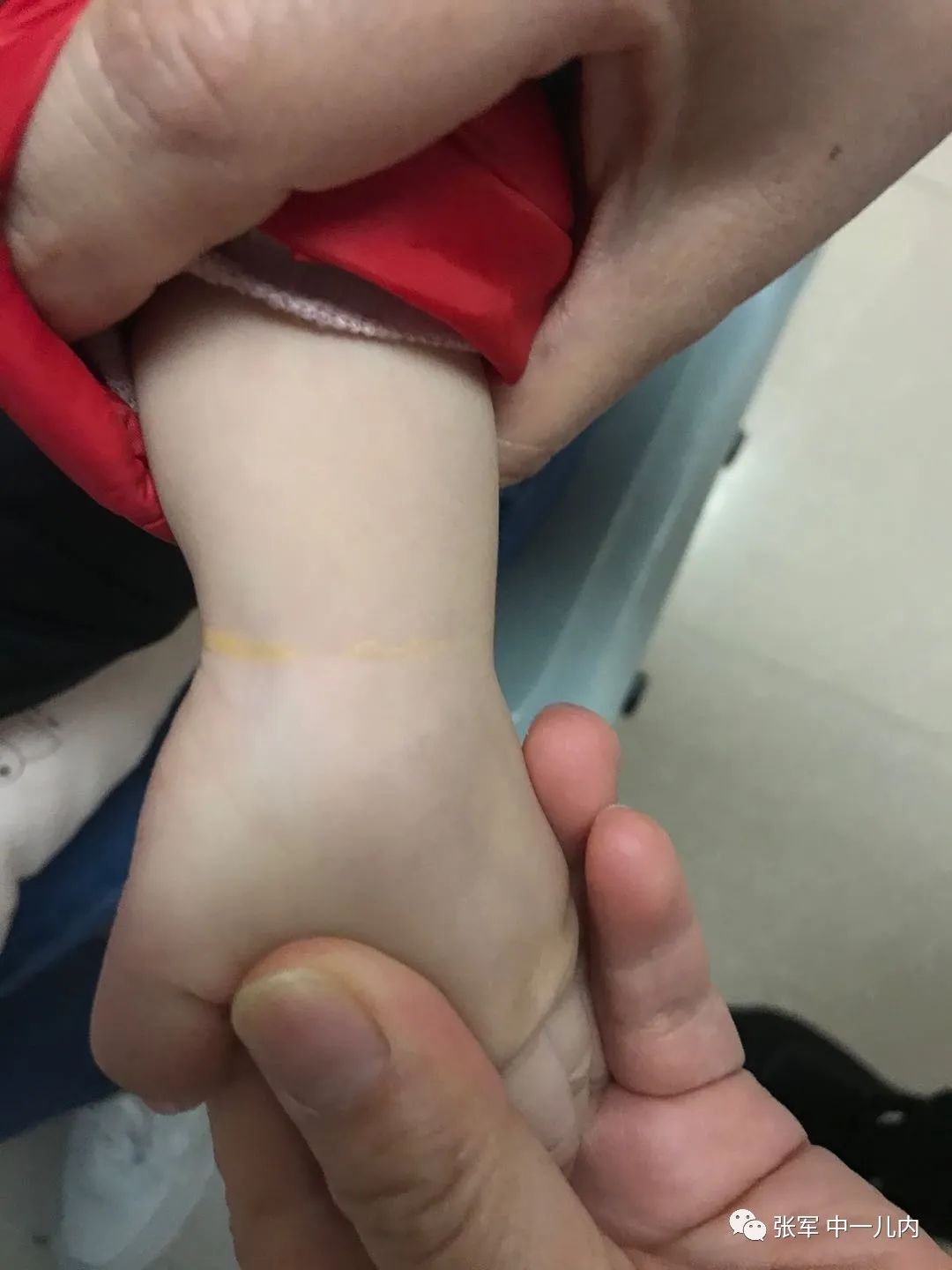 单纯乳房发育的，最后都是好结局吗？