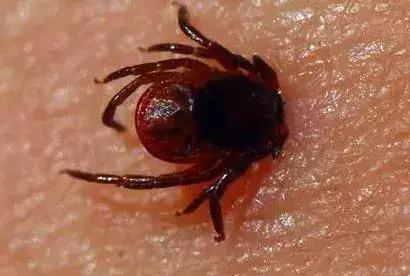 天热有蚊子宝宝怎么办,天热宝宝身上老痒怎么治