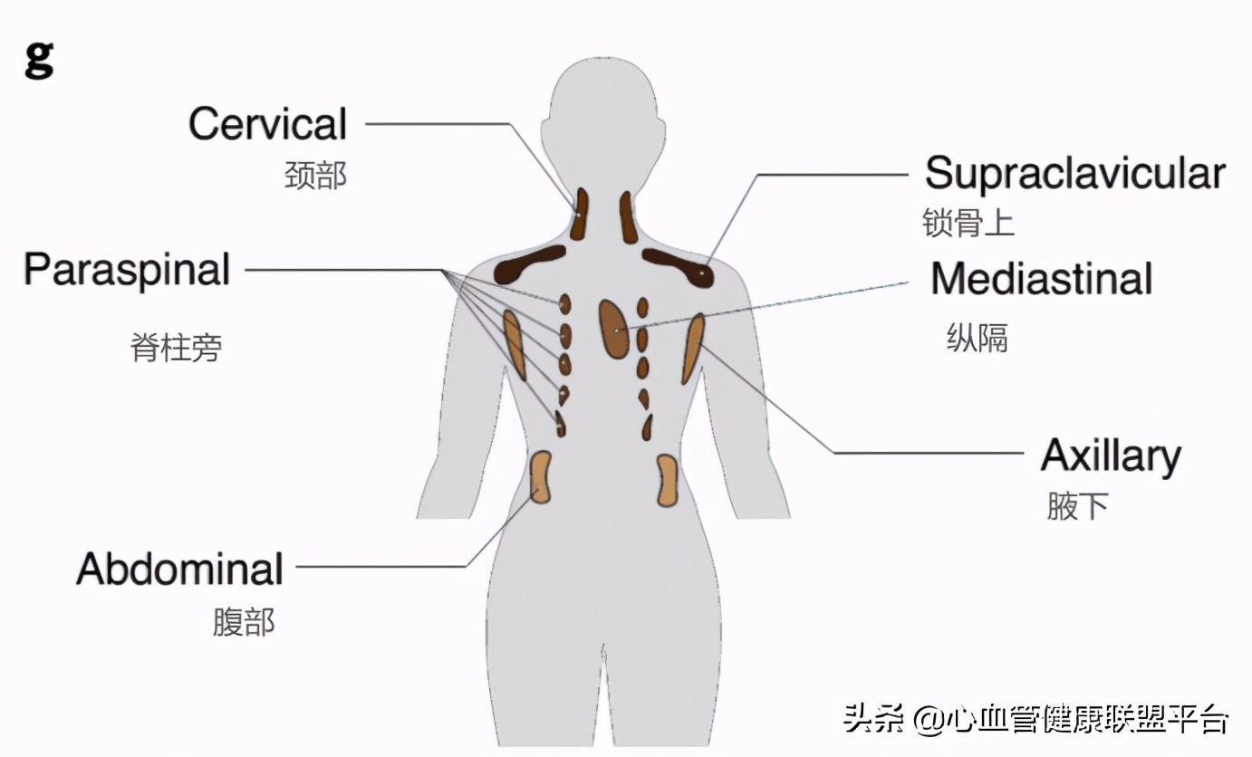 脂肪有好坏之分,脂肪种类很多也有优劣之分