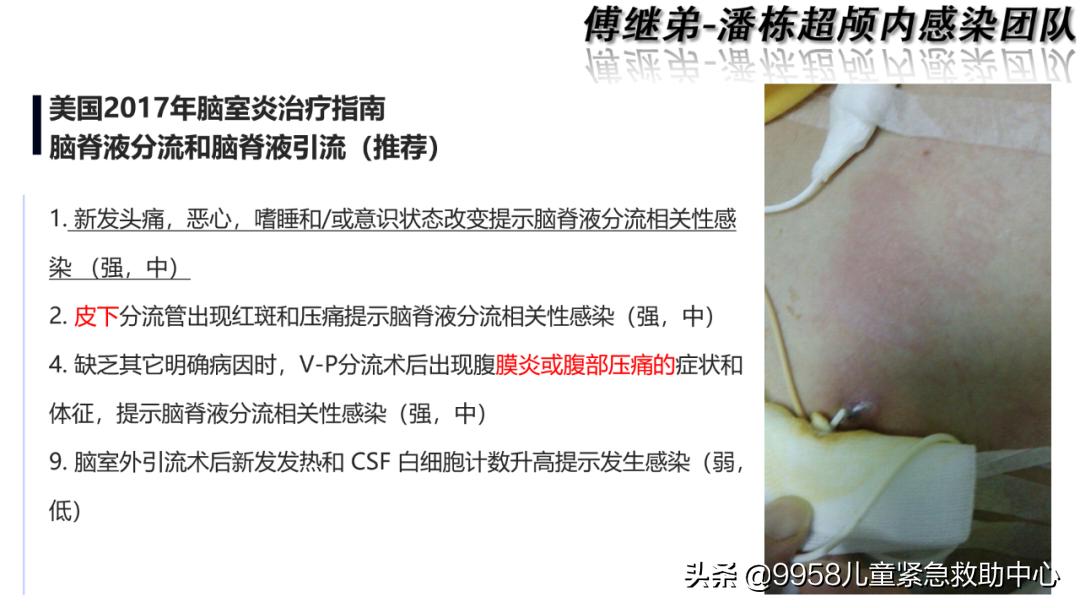 颅内感染康复治疗知识,小儿颅内感染的健康宣教