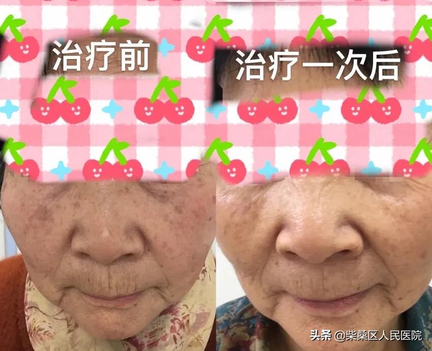 激光医疗美容机构,九江柴桑区专业祛斑祛痘店