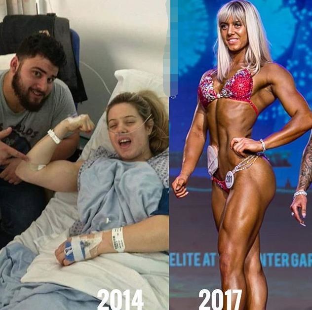 中国100万造口人：改道的肠子，改变的人生