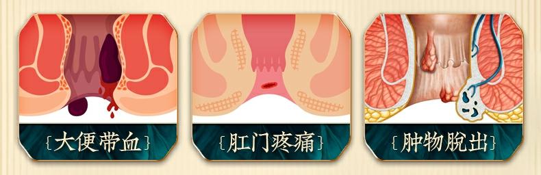 痔疮便血饮食如何调理,痔疮便血怎么办什么方法最有效