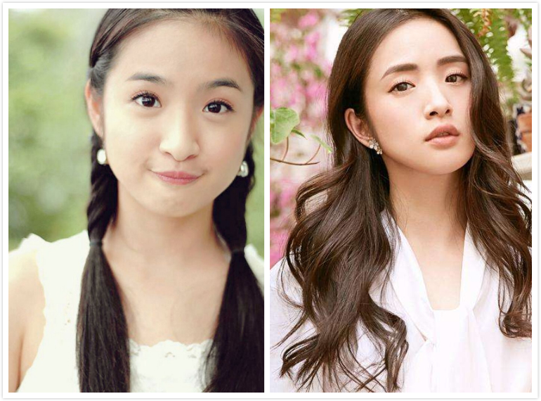 怎么判断脸是不是脂肪脸,怎么判断自己的脸是不是油脸