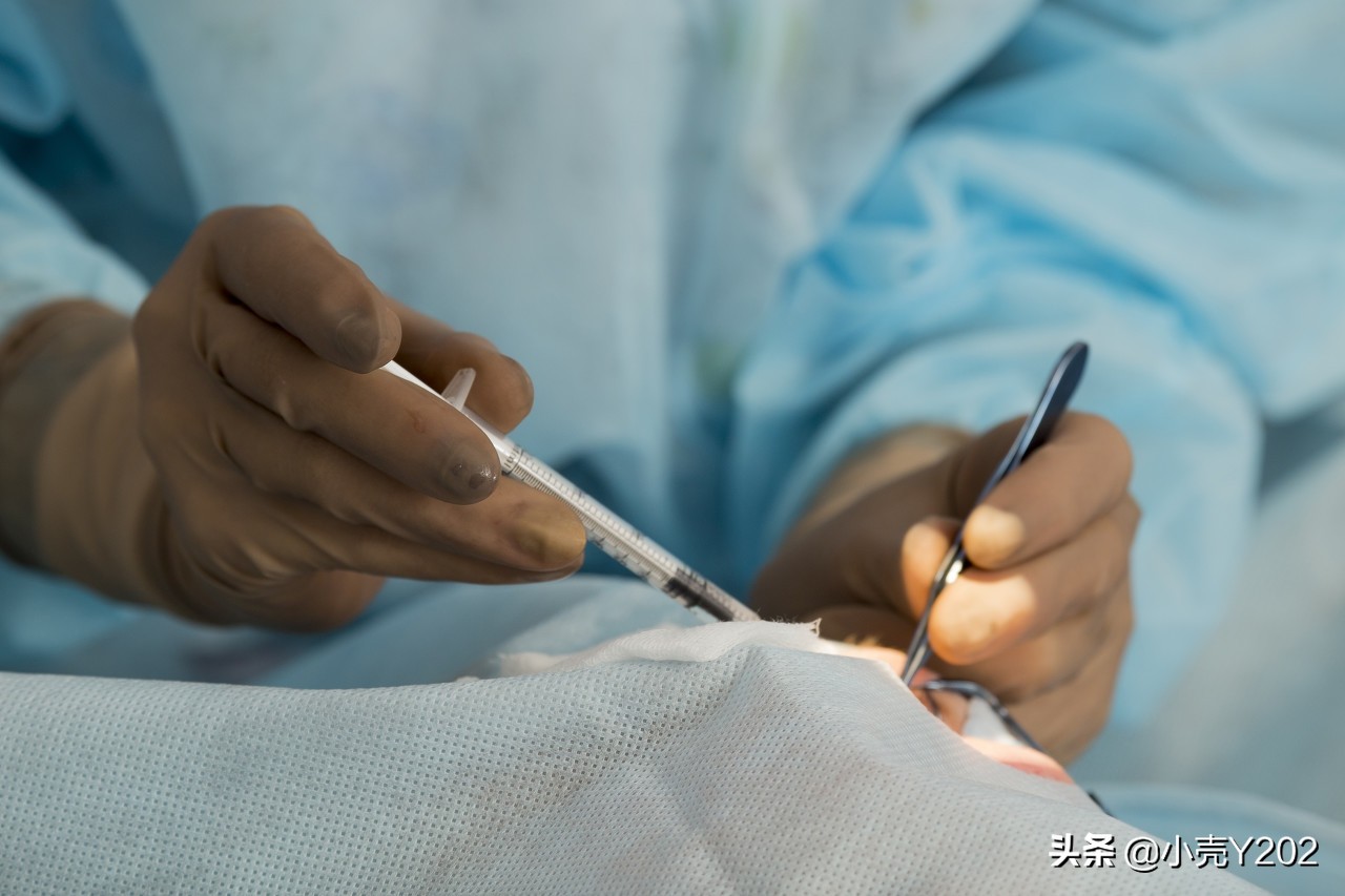 原发性视网膜脱落的原因与治疗,复杂性视网膜脱落