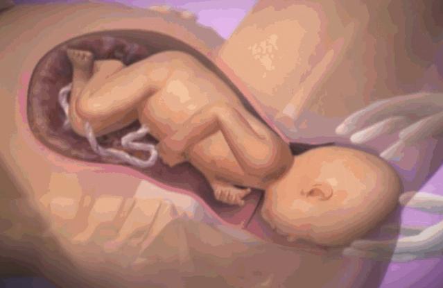 3D实图还原女性分娩全过程，没有一个妈妈能笑着看完