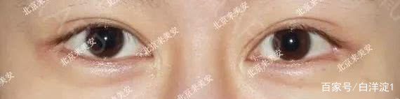 名门泽佳的正确涂法,名门泽佳祛皱小细节