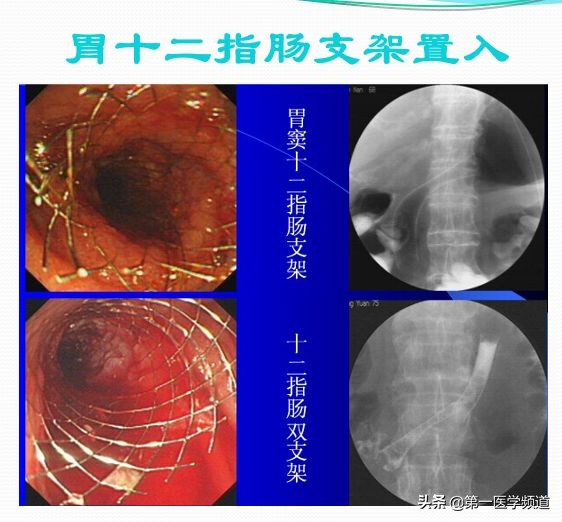 「医影传声」上海交通大学医学院附属瑞金医院卢湾分院放射科主任
