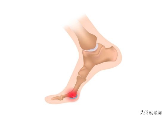 跑鞋鞋码怎样才是最合脚,怎么判断跑鞋鞋码是否合脚