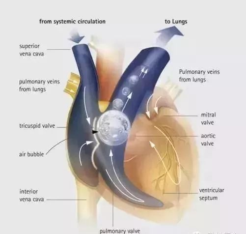 双氧水给土壤消毒,双氧水给物体消毒